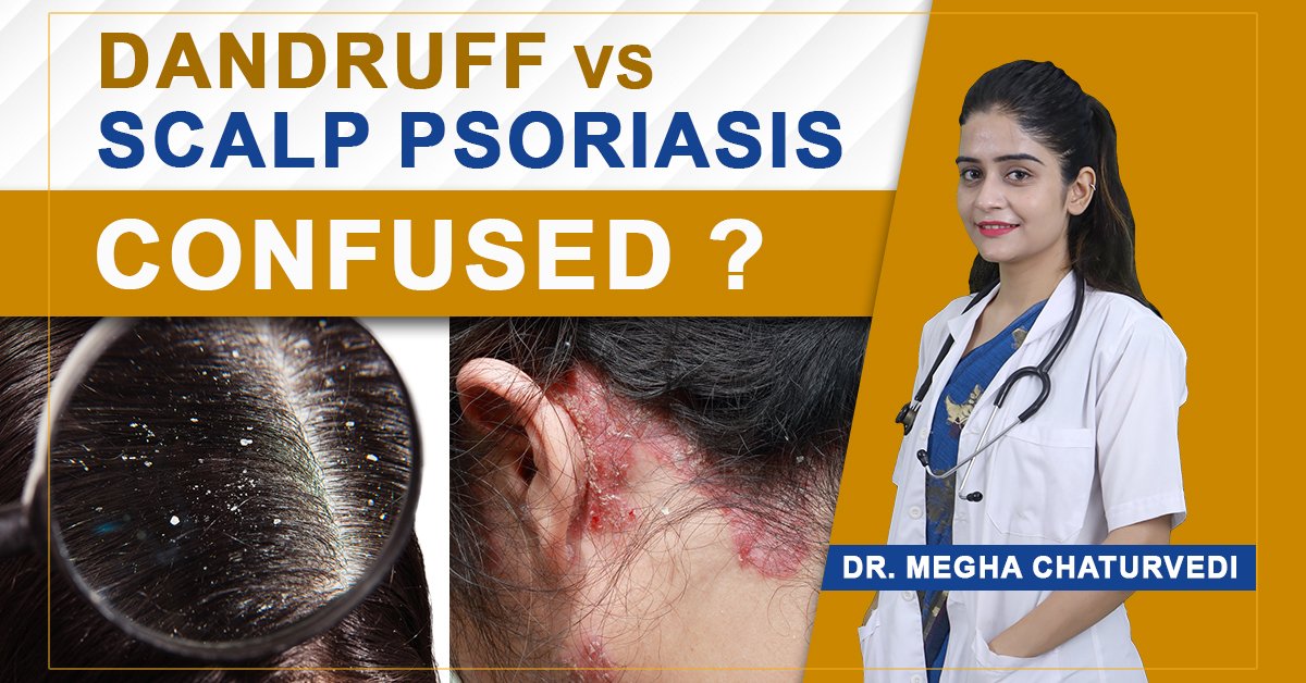 Webinar – My approach to managing scalp psoriasis and seborrheic dermatitis in Primary Care